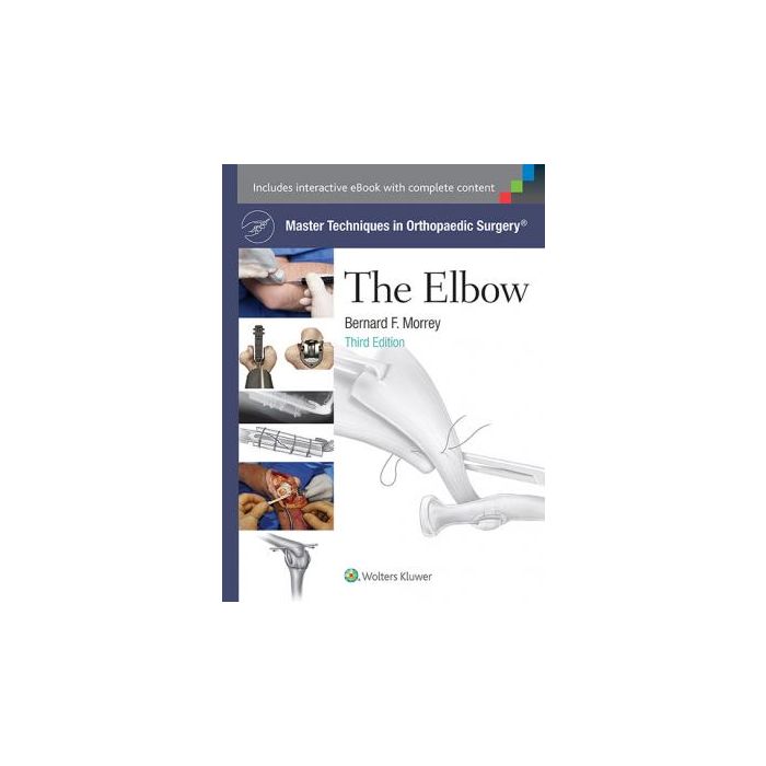 Master Techniques in Orthopaedic Surgery: The Elbow, 3ed. - Morrey Bernard F. - LIPPINCOTT Williams and Wilkins - 9781451173093