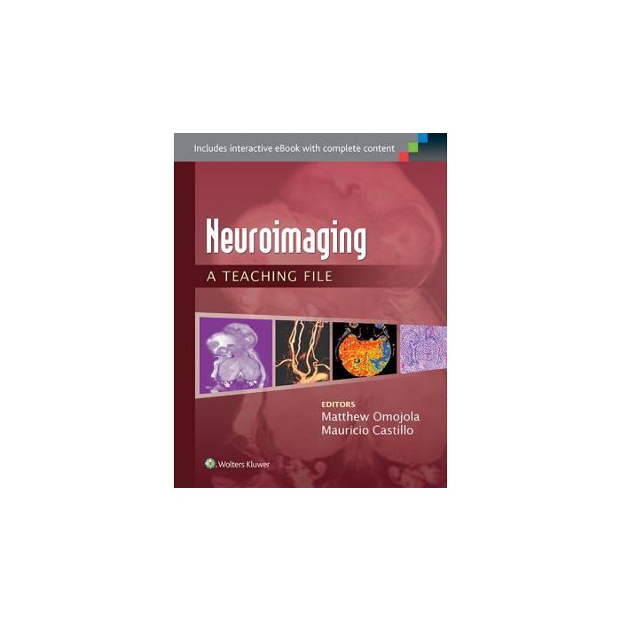 Neuroimaging: A Teaching File - Omojola Matthew; Castillo Mauricio - LIPPINCOTT Williams and Wilkins - 9781451173284 Neuroimaging: A Teaching File - Omojola Matthew; Castillo Mauricio - LIPPINCOTT Williams and Wilkins - 9781451173284