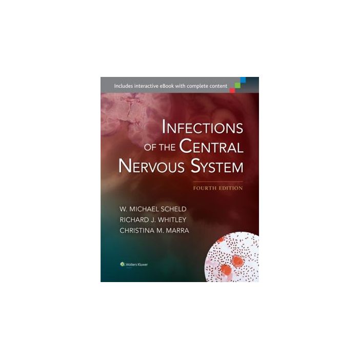 Infections of the Central Nervous System, 4ed. - Scheld W. Michael; Whitley Richard J.; Marra Christina M. - LIPPINCOTT Williams and Wilkins - 9781451173727