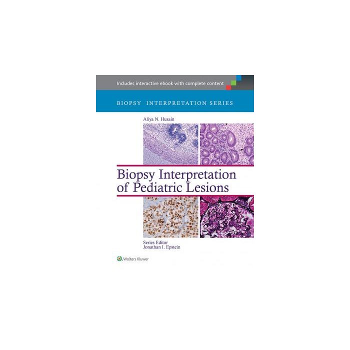 Biopsy Interpretation of Pediatric Lesions - Husain Aliya N. - LIPPINCOTT Williams and Wilkins - 9781451175332