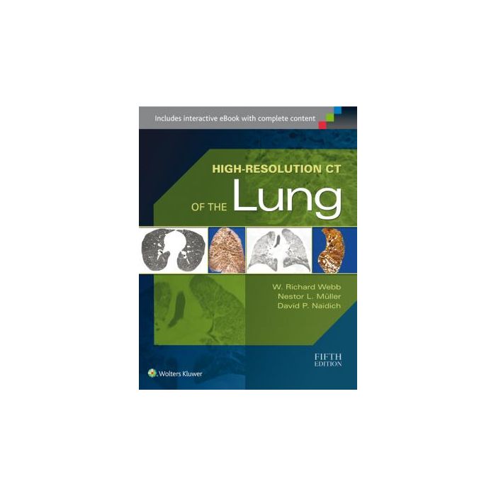 High-Resolution CT of the Lung, 5ed. - Webb W. Richard; Muller Nestor L.; Naidich David P. - LIPPINCOTT Williams and Wilkins - 9781451176018 High-Resolution CT of the Lung, 5ed. - Webb W. Richard; Muller Nestor L.; Naidich David P. - LIPPINCOTT Williams and Wilkins - 9781451176018