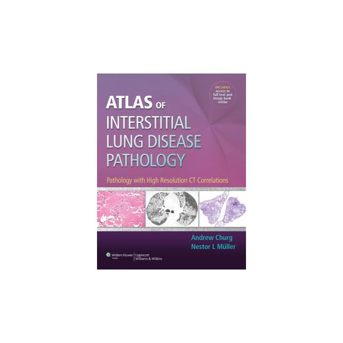 Atlas of Interstitial Lung Disease Pathology Churg Andrew LIPPINCOTT Williams and Wilkins 9781451176438 Atlas of Interstitial Lung Disease Pathology Churg Andrew LIPPINCOTT Williams and Wilkins 9781451176438