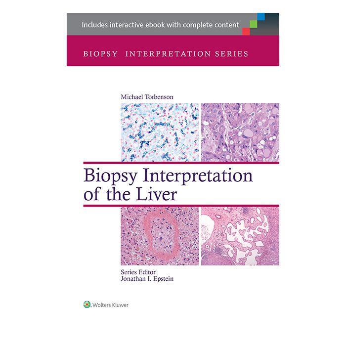 Biopsy Interpretation of the Liver - Torbenson Michael - LIPPINCOTT Williams and Wilkins - 9781451182576 Biopsy Interpretation of the Liver - Torbenson Michael - LIPPINCOTT Williams and Wilkins - 9781451182576