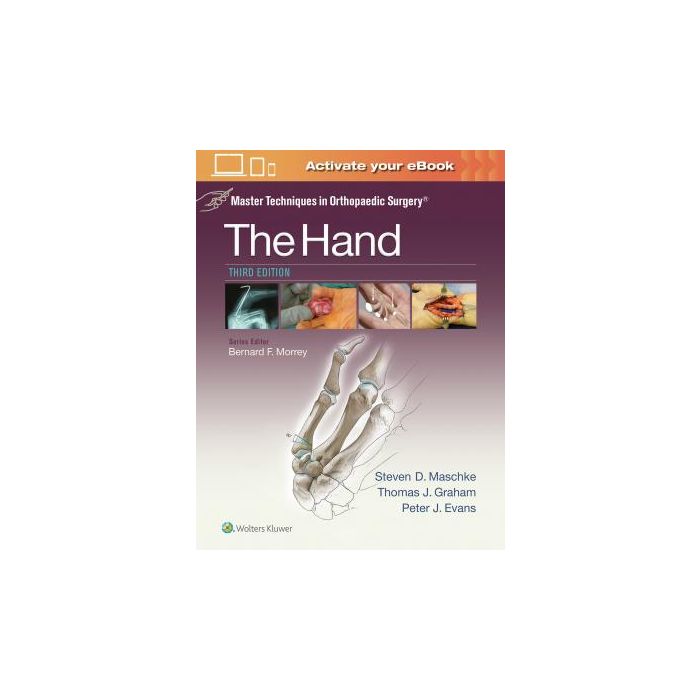 Master Techniques in Orthopaedic Surgery: The Hand, 3ed. Graham Thomas J.; Maschke Steven; Evans Peter LIPPINCOTT Williams and Wilkins 9781451182781 Master Techniques in Orthopaedic Surgery: The Hand, 3ed. Graham Thomas J.; Maschke Steven; Evans Peter LIPPINCOTT Williams and Wilkins 9781451182781