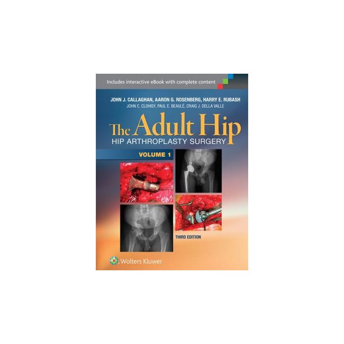 The Adult Hip. Hip Arthroplasty Surgery, 3ed. Two volume set Callaghan John J. LIPPINCOTT Williams and Wilkins 9781451183696 The Adult Hip. Hip Arthroplasty Surgery, 3ed. Two volume set Callaghan John J. LIPPINCOTT Williams and Wilkins 9781451183696