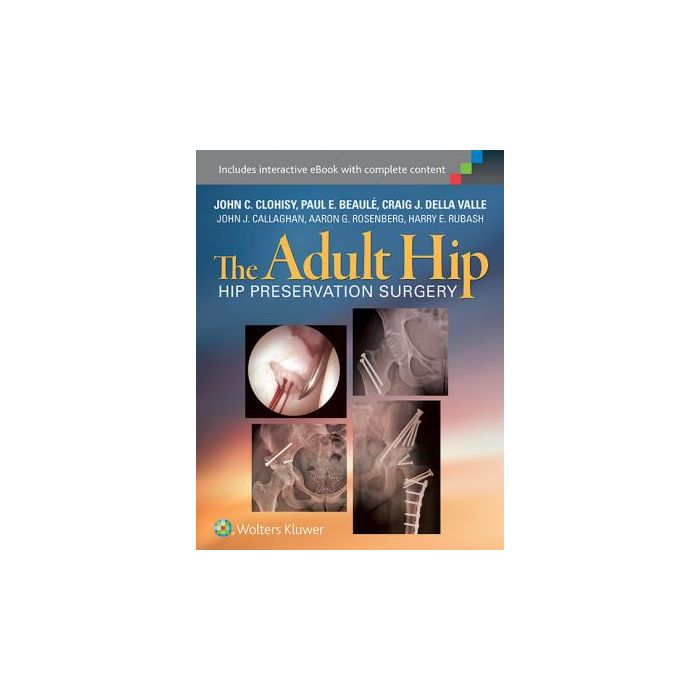 The Adult Hip. Hip Preservation Surgery Clohisy John; Beaule Paul; DellaValle Craig; Callaghan John J.; Rosenberg Aaron G.; Rubash Harry E. LIPPINCOTT Williams and Wilkins 9781451183931 The Adult Hip. Hip Preservation Surgery Clohisy John; Beaule Paul; DellaValle Craig; Callaghan John J.; Rosenberg Aaron G.; Rubash Harry E. LIPPINCOTT Williams and Wilkins 9781451183931