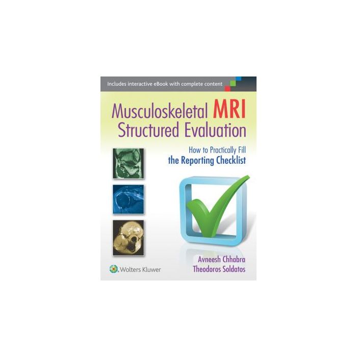 Musculoskeletal MRI Structured Evaluation - Chhabra Avneesh; Soldatos Theodoros - LIPPINCOTT Williams and Wilkins - 9781451185935 Musculoskeletal MRI Structured Evaluation - Chhabra Avneesh; Soldatos Theodoros - LIPPINCOTT Williams and Wilkins - 9781451185935