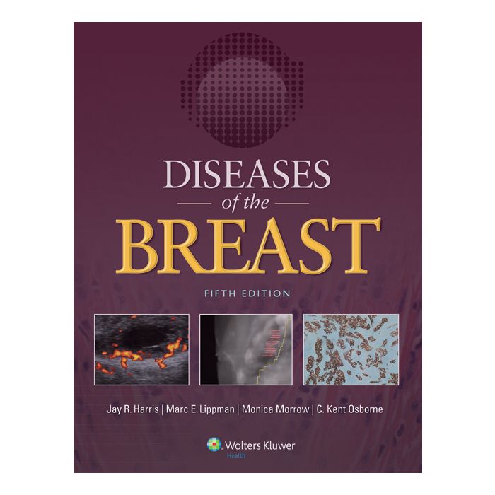 Diseases of the Breast 5ed. - Harris Jay R.; Lippman Marc E.; Morrow Monica; Osborne C. Kent - LIPPINCOTT Williams and Wilkins - 9781451186277