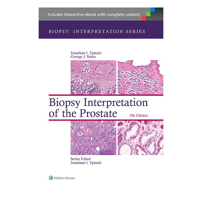 Biopsy Interpretation of the Prostate, 5ed. - Epstein Jonathan I.; Netto George J. - LIPPINCOTT Williams and Wilkins - 9781451186741