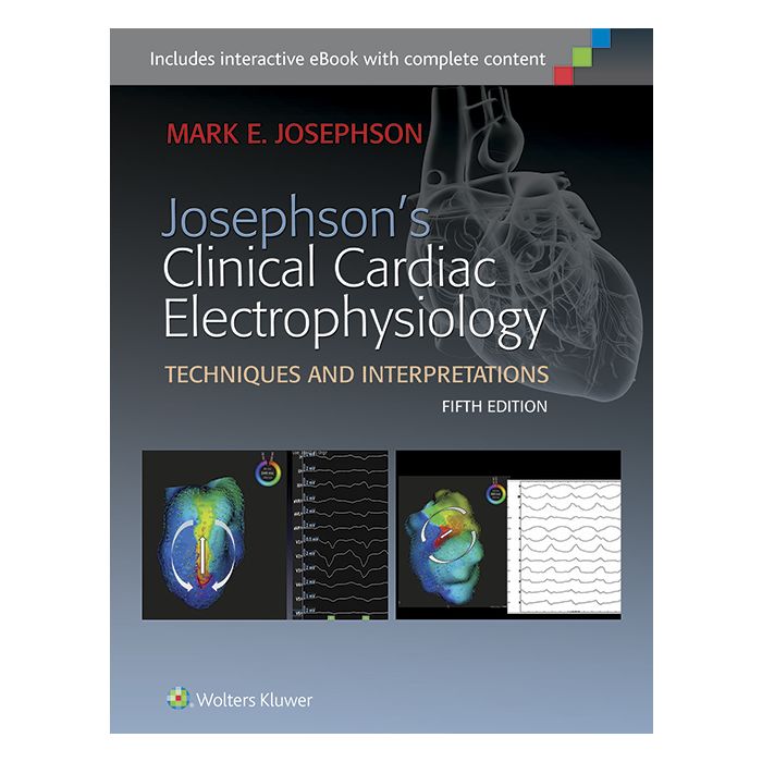 Josephson's Clinical Cardiac Electrophysiology, 5ed. Josephson Mark E. LIPPINCOTT Williams and Wilkins 9781451187410 Josephson's Clinical Cardiac Electrophysiology, 5ed. Josephson Mark E. LIPPINCOTT Williams and Wilkins 9781451187410