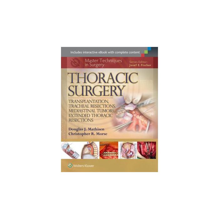 Master Techniques in Surgery: Thoracic Surgery: Transplantation, Tracheal Resections, Mediastinal Tumors, Extended Thoracic Resections - Mathisen Douglas J.; Morse Christopher - LIPPINCOTT Williams and Wilkins - 9781451190724
