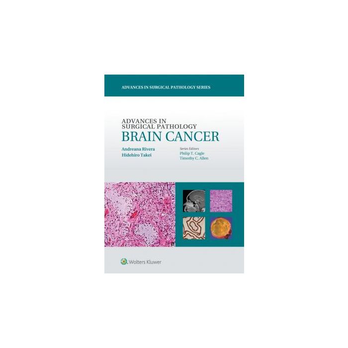 Advances in Surgical Pathology: Brain Cancer Rivera Andreana; Takei Hidehiro LIPPINCOTT Williams and Wilkins 9781451190915 Advances in Surgical Pathology: Brain Cancer Rivera Andreana; Takei Hidehiro LIPPINCOTT Williams and Wilkins 9781451190915