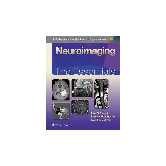 Neuroimaging: The Essentials Sanelli Pina; Schaefer Pamela; Loevner Laurie LIPPINCOTT Williams and Wilkins 9781451191356 Neuroimaging: The Essentials Sanelli Pina; Schaefer Pamela; Loevner Laurie LIPPINCOTT Williams and Wilkins 9781451191356