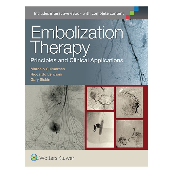 Embolization Therapy: Principles and Clinical Applications - Guimaraes Marcelo; Lencioni Riccardo; Siskin Gary - LIPPINCOTT Williams and Wilkins - 9781451191448 Embolization Therapy: Principles and Clinical Applications - Guimaraes Marcelo; Lencioni Riccardo; Siskin Gary - LIPPINCOTT Williams and Wilkins - 9781451191448
