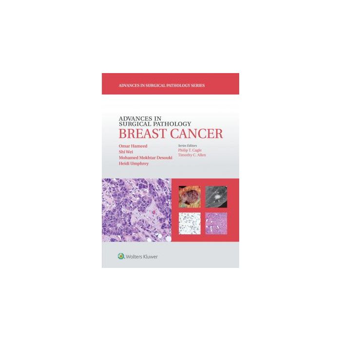 Advances in Surgical Pathology: Breast Cancer  Hameed Omar; Wei Shi; Desouki Mohamed Mokhtar; Umphrey Heidi   LIPPINCOTT Williams and Wilkins  9781451191714
