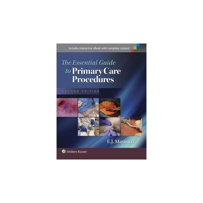 The Essential Guide to Primary Care Procedures, 2ed.  Mayeaux E. J.  LIPPINCOTT Williams and Wilkins  9781451191868