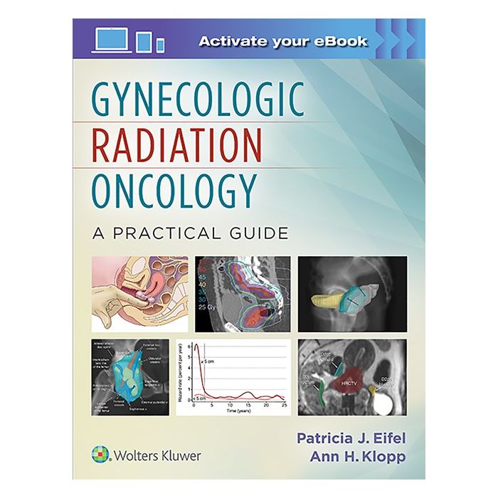 Gynecologic Radiation Oncology: A Practical Guide Eifel Patricia; Klopp Ann H. LIPPINCOTT Williams and Wilkins 9781451192650 Gynecologic Radiation Oncology: A Practical Guide Eifel Patricia; Klopp Ann H. LIPPINCOTT Williams and Wilkins 9781451192650
