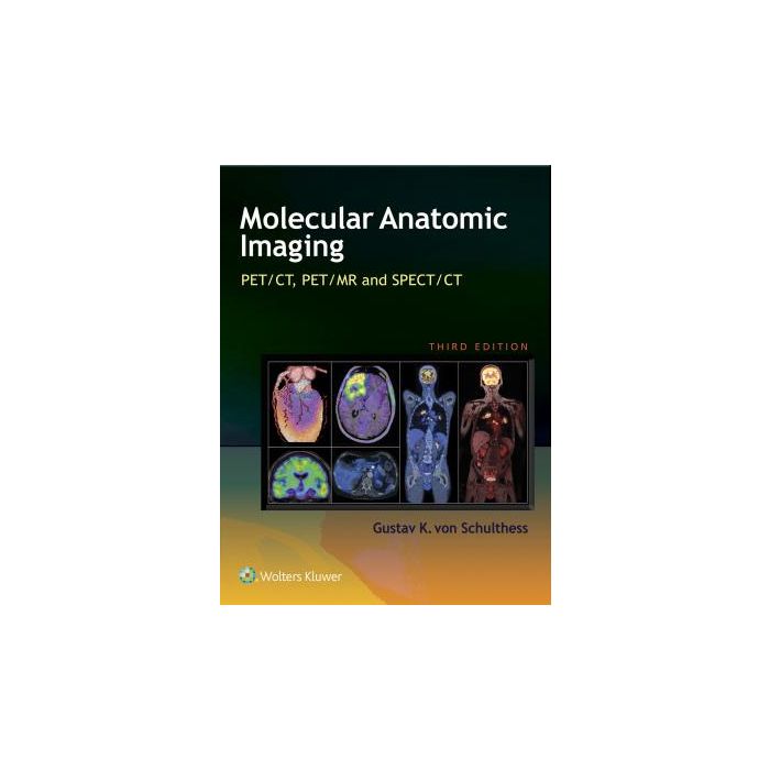 Molecular Anatomic Imaging, 3ed.  Von Schulthess Gustav K.  LIPPINCOTT Williams and Wilkins  9781451192667