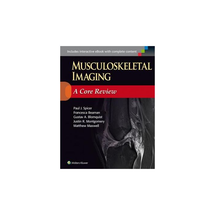 Musculoskeletal Imaging: A Core Review - Spicer Paul - LIPPINCOTT Williams and Wilkins - 9781451192674 Musculoskeletal Imaging: A Core Review - Spicer Paul - LIPPINCOTT Williams and Wilkins - 9781451192674