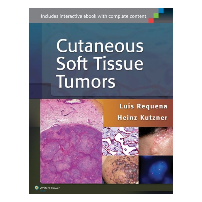 Cutaneous Soft Tissue Tumors - Requena Luis; Kutzner Heinz - LIPPINCOTT Williams and Wilkins - 9781451192766