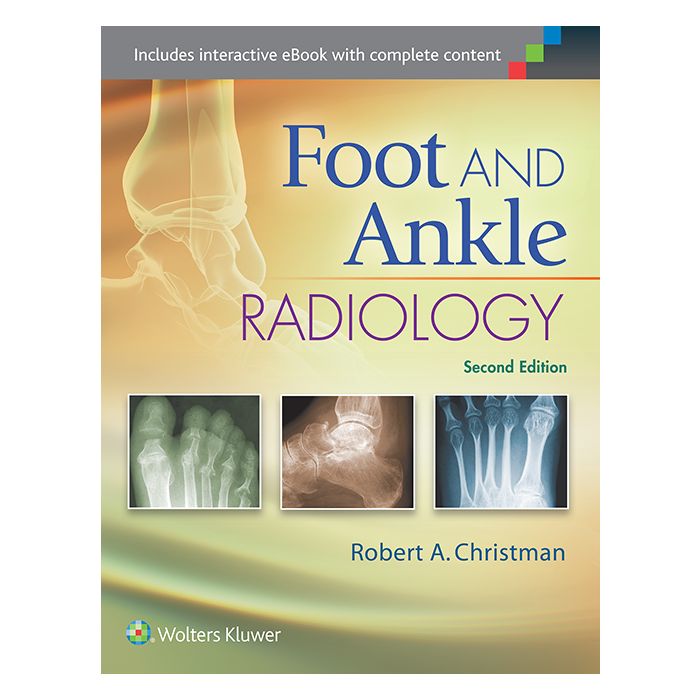 Foot and Ankle Radiology, 2ed. - Christman Robert - LIPPINCOTT Williams and Wilkins - 9781451192834 Foot and Ankle Radiology, 2ed. - Christman Robert - LIPPINCOTT Williams and Wilkins - 9781451192834