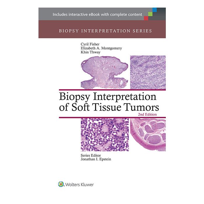 Biopsy Interpretation of Soft Tissue Tumors, 2ed.  Fisher Cyril; Montgomery Elizabeth; Thway Khin  LIPPINCOTT Williams and Wilkins  9781451192995