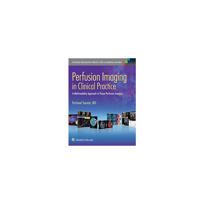 Perfusion Imaging in Clinical Practice  Saremi Farhood  LIPPINCOTT Williams and Wilkins  9781451193169 Perfusion Imaging in Clinical Practice  Saremi Farhood  LIPPINCOTT Williams and Wilkins  9781451193169