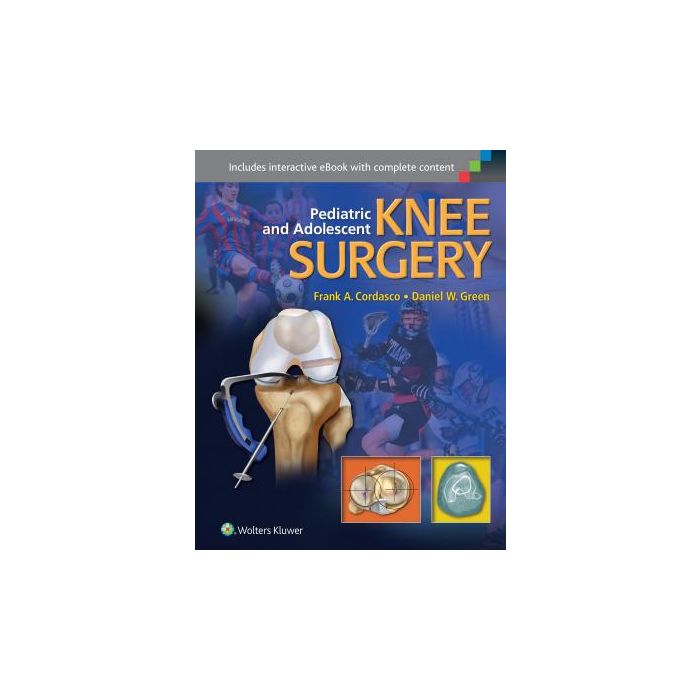 Pediatric and Adolescent Knee Surgery Cordasco Frank; Green Daniel LIPPINCOTT Williams and Wilkins 9781451193350 Pediatric and Adolescent Knee Surgery Cordasco Frank; Green Daniel LIPPINCOTT Williams and Wilkins 9781451193350
