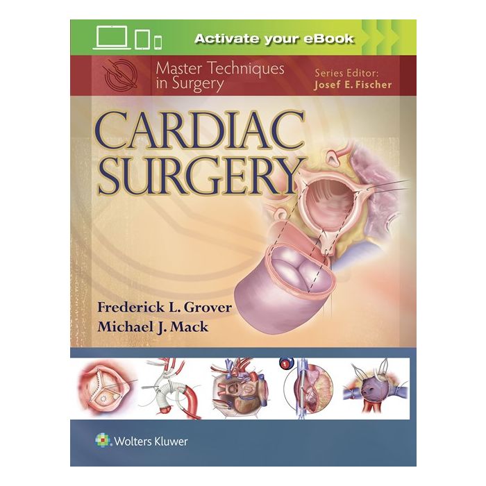 Master Techniques in Surgery: Cardiac Surgery Grover Frederick; Mack Michael J. LIPPINCOTT Williams and Wilkins 9781451193534 Master Techniques in Surgery: Cardiac Surgery Grover Frederick; Mack Michael J. LIPPINCOTT Williams and Wilkins 9781451193534