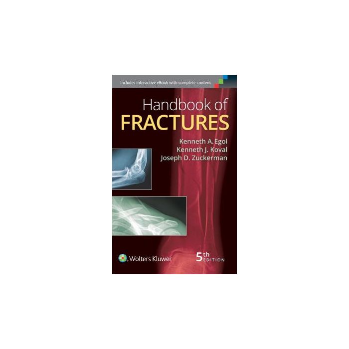 Handbook of Fractures, 5ed. - Egol Kenneth; Koval Kenneth J.; Zuckerman Joseph - LIPPINCOTT Williams and Wilkins - 9781451193626 Handbook of Fractures, 5ed. - Egol Kenneth; Koval Kenneth J.; Zuckerman Joseph - LIPPINCOTT Williams and Wilkins - 9781451193626