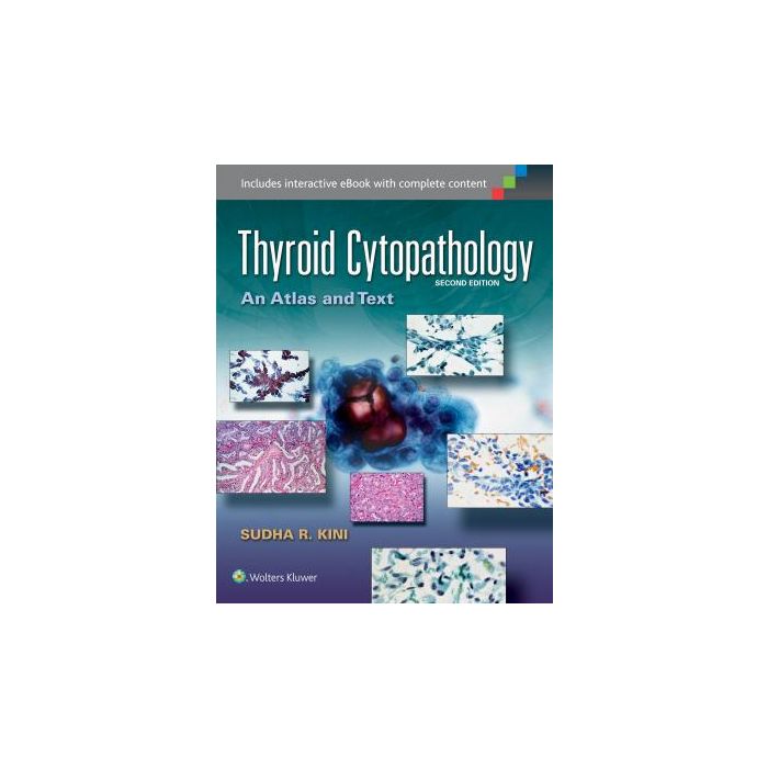 Thyroid Cytopathology, 2ed.  Kini Sudha R.  LIPPINCOTT Williams and Wilkins  9781451193893