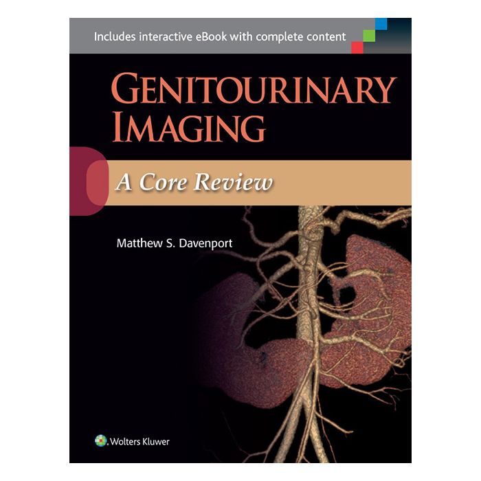Genitourinary Imaging: A Core Review - Davenport Matthew - LIPPINCOTT Williams and Wilkins - 9781451194074