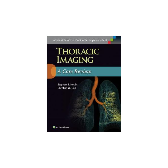 Thoracic Imaging: A Core Review  Hobbs Stephen; Cox Christian  LIPPINCOTT Williams and Wilkins  9781469898834