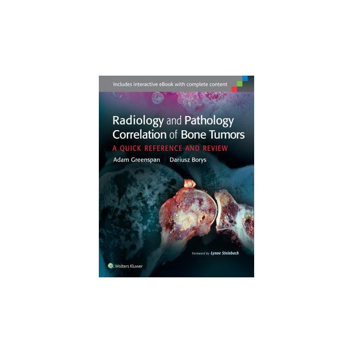 Radiology and Pathology Correlation of Bone Tumors Greenspan Adam; Borys Dariusz LIPPINCOTT Williams and Wilkins 9781469898872 Radiology and Pathology Correlation of Bone Tumors Greenspan Adam; Borys Dariusz LIPPINCOTT Williams and Wilkins 9781469898872