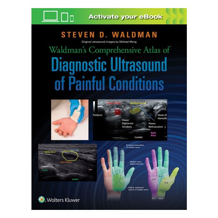 Waldman's Comprehensive Atlas of Diagnostic Ultrasound of Painful Conditions Waldman Steven LIPPINCOTT Williams and Wilkins 9781496302892 Waldman's Comprehensive Atlas of Diagnostic Ultrasound of Painful Conditions Waldman Steven LIPPINCOTT Williams and Wilkins 9781496302892