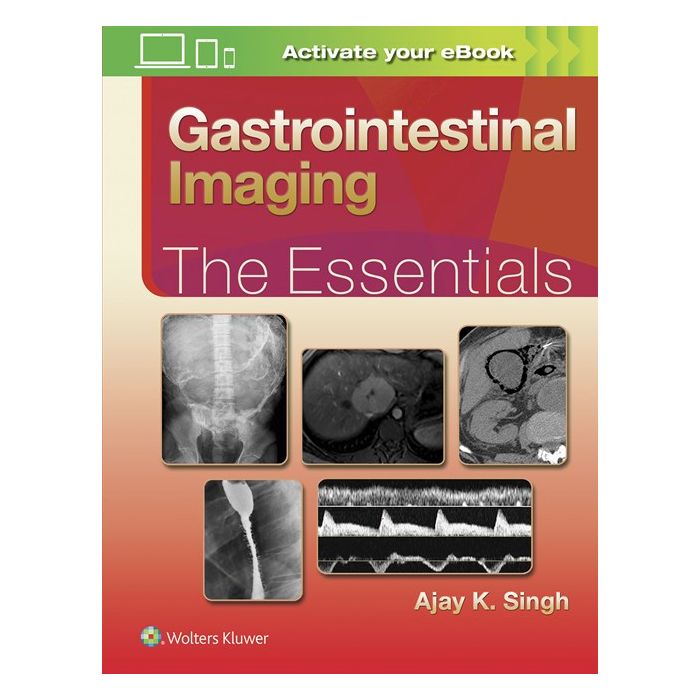 Gastrointestinal Imaging: The Essentials  Singh Ajay LIPPINCOTT Williams and Wilkins  9781496307194