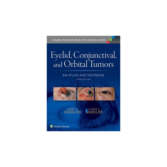Eyelid, Conjunctival, and Orbital Tumors: An Atlas and Textbook, 3ed.  Shields Jerry A.; Shields Carol L.  LIPPINCOTT Williams and Wilkins  9781496321480
