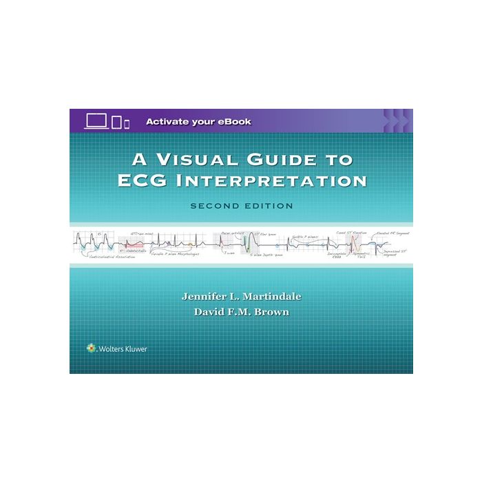 A Visual Guide to ECG Interpretation, 2ed.  Martindale Jennifer L.; Brown David F.M.  LIPPINCOTT Williams and Wilkins  9781496321534