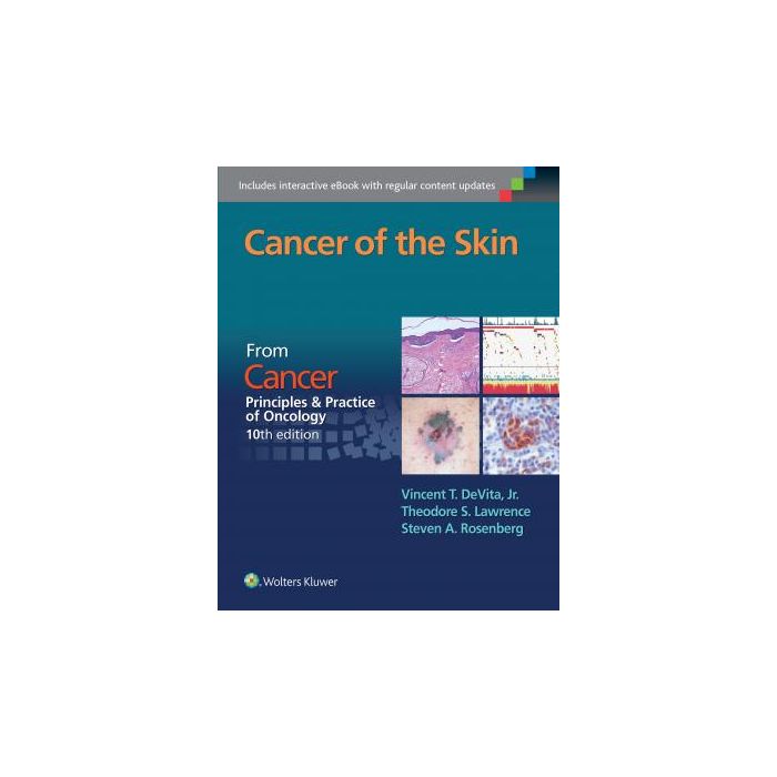 Cancer of the Skin. From Cancer: Principles & Practice of Oncology, 10ed.  DeVita Vincent T.; Lawrence Theodore S.; Rosenberg Steven A.  LIPPINCOTT Williams and Wilkins  9781496333933
