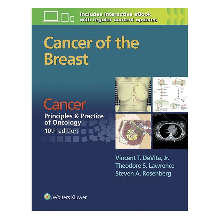 Cancer of the Breast. From Cancer: Principles & Practice of Oncology, 10/ed.  DeVita Vincent T.; Lawrence Theodore S.; Rosenberg Steven A.  LIPPINCOTT Williams and Wilkins  9781496333988