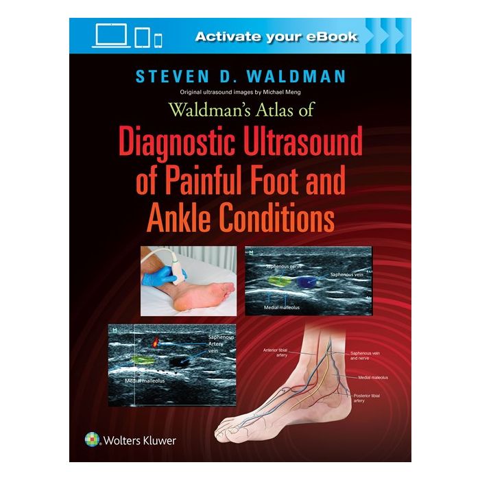 Waldman's Atlas of Diagnostic Ultrasound of Painful Foot and Ankle Conditions Waldman Steven LIPPINCOTT Williams and Wilkins 9781496345462 Waldman's Atlas of Diagnostic Ultrasound of Painful Foot and Ankle Conditions Waldman Steven LIPPINCOTT Williams and Wilkins 9781496345462