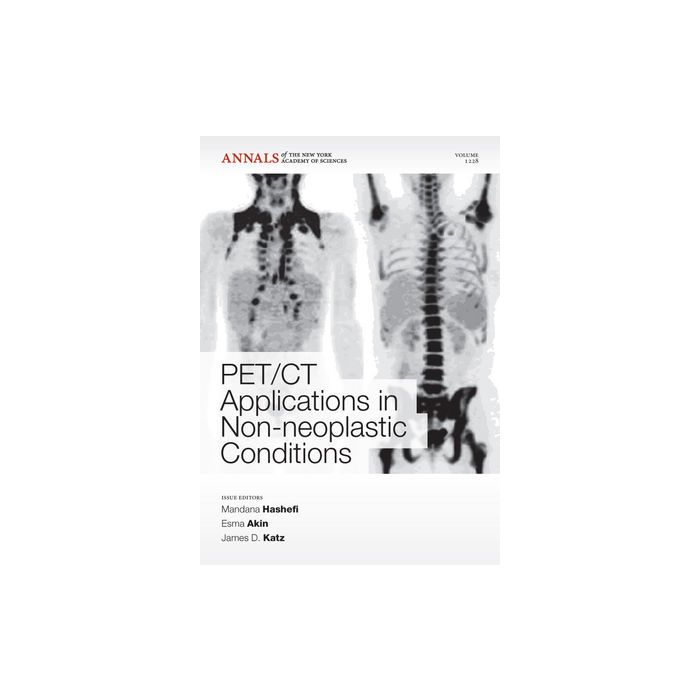 PET CT Applications in Non-Neoplastic Conditions Hashefi Mandana; Akin Esma; Katz James D. Wiley - Blackwell 9781573318181 PET CT Applications in Non-Neoplastic Conditions Hashefi Mandana; Akin Esma; Katz James D. Wiley - Blackwell 9781573318181