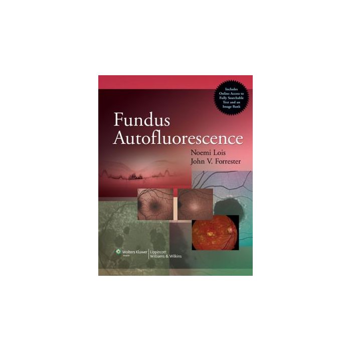 Fundus Autofluorescence Lois Noemi; Forrester John V. LIPPINCOTT Williams and Wilkins 9781582557991 Fundus Autofluorescence Lois Noemi; Forrester John V. LIPPINCOTT Williams and Wilkins 9781582557991