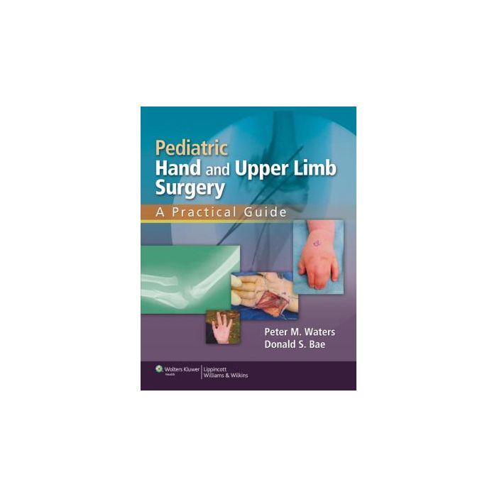 Pediatric Hand and Upper Limb Surgery Waters Peter M.; Bae Donald S. LIPPINCOTT Williams and Wilkins 9781582558707 Pediatric Hand and Upper Limb Surgery Waters Peter M.; Bae Donald S. LIPPINCOTT Williams and Wilkins 9781582558707