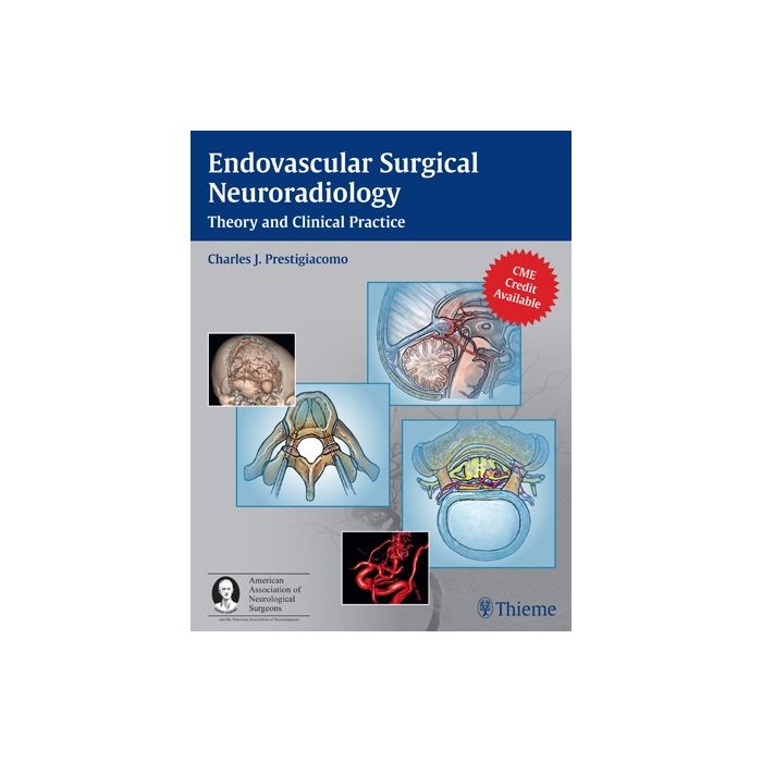 Endovascular Surgical Neuroradiology. Theory and Clinical Practice  Prestigiacomo Charles J.  Thieme Medical Publishers  9781604060577