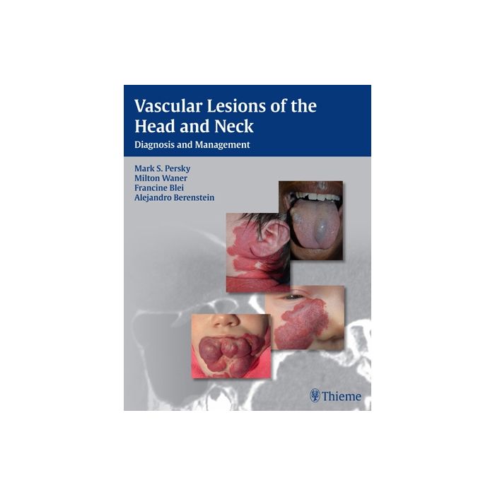 Vascular Lesions of the Head and Neck. Diagnosis and Management Persky Mark S.; Waner Milton; Blei Francine; Berenstein Alejandro Thieme Medical Publishers 9781604060591 Vascular Lesions of the Head and Neck. Diagnosis and Management Persky Mark S.; Waner Milton; Blei Francine; Berenstein Alejandro Thieme Medical Publishers 9781604060591