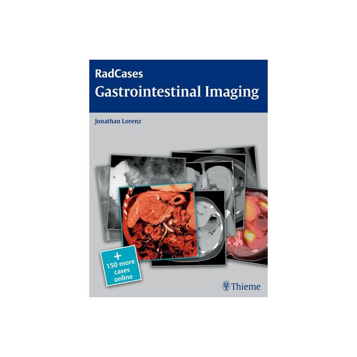 Gastrointestinal Imaging  Lorenz Jonathan M.  Thieme Medical Publishers  9781604061833 Gastrointestinal Imaging  Lorenz Jonathan M.  Thieme Medical Publishers  9781604061833