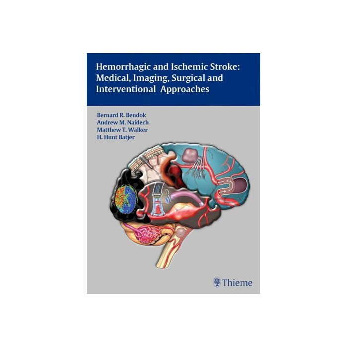 Hemorrhagic and Ischemic Stroke. Medical, Imaging, Surgical and Interventional Approaches Bendok Bernard R.; Naidech Andrew M.; Walker Matthew T.; Batjer H. Hunt Thieme Medical Publishers 9781604062342 Hemorrhagic and Ischemic Stroke. Medical, Imaging, Surgical and Interventional Approaches Bendok Bernard R.; Naidech Andrew M.; Walker Matthew T.; Batjer H. Hunt Thieme Medical Publishers 9781604062342