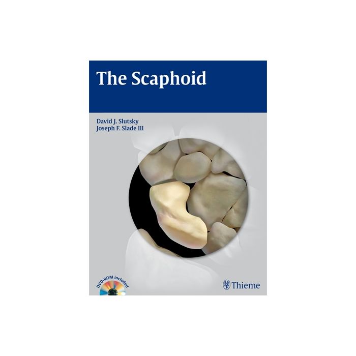 The Scaphoid  Slutsky David J.; Slade Joseph F.  Thieme Medical Publishers  9781604062373 The Scaphoid  Slutsky David J.; Slade Joseph F.  Thieme Medical Publishers  9781604062373
