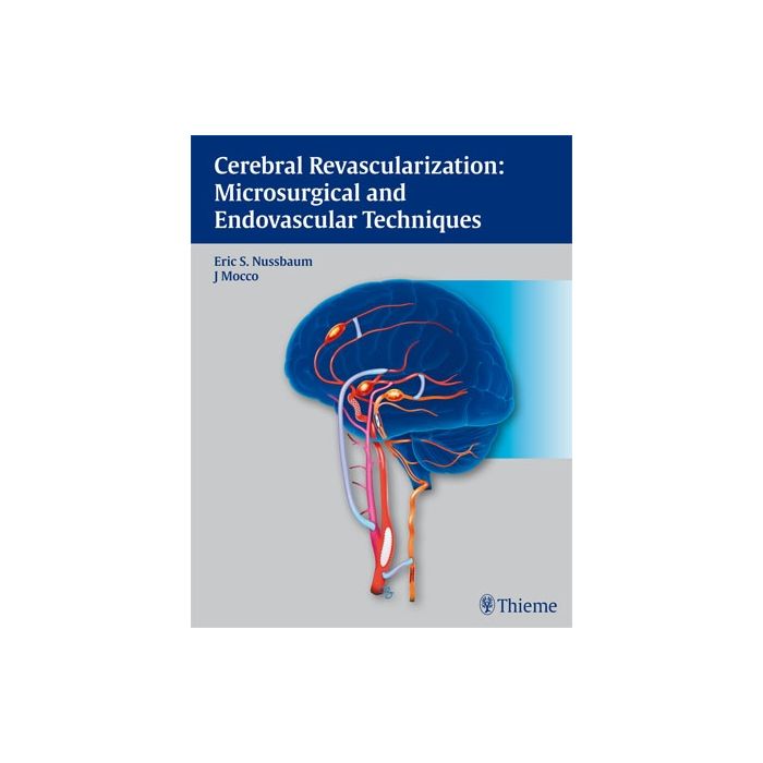 Cerebral Revascularization: Microsurgical and Endovascular Techniques  Nussbaum Eric; Mocco J  Thieme Medical Publishers  9781604062632